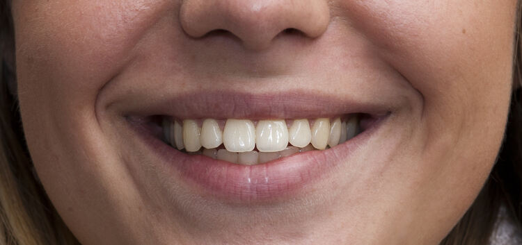 Strahlendes Lächeln - weiße Zähne: Das ist nicht nur am „Tag der Zahngesundheit“ gefragt.